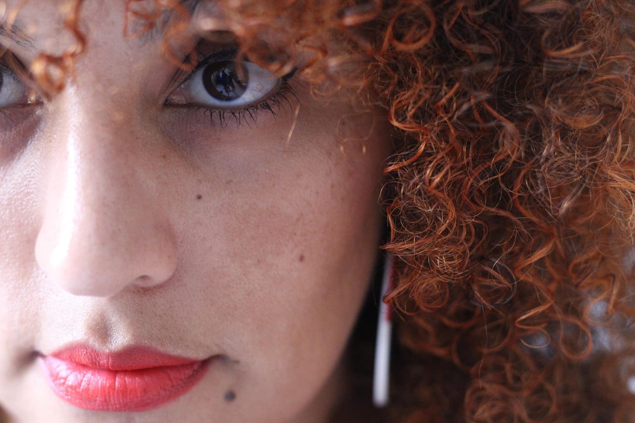 Countering Hyperpigmentation With Lasers: New Research