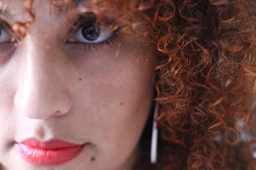 Countering Hyperpigmentation With Lasers: New Research