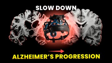 THIS Device Counters MCI/Alzheimer - Here’s The Data