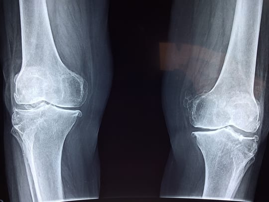 Red Light Therapy For Knee: Devices And Practical Tips